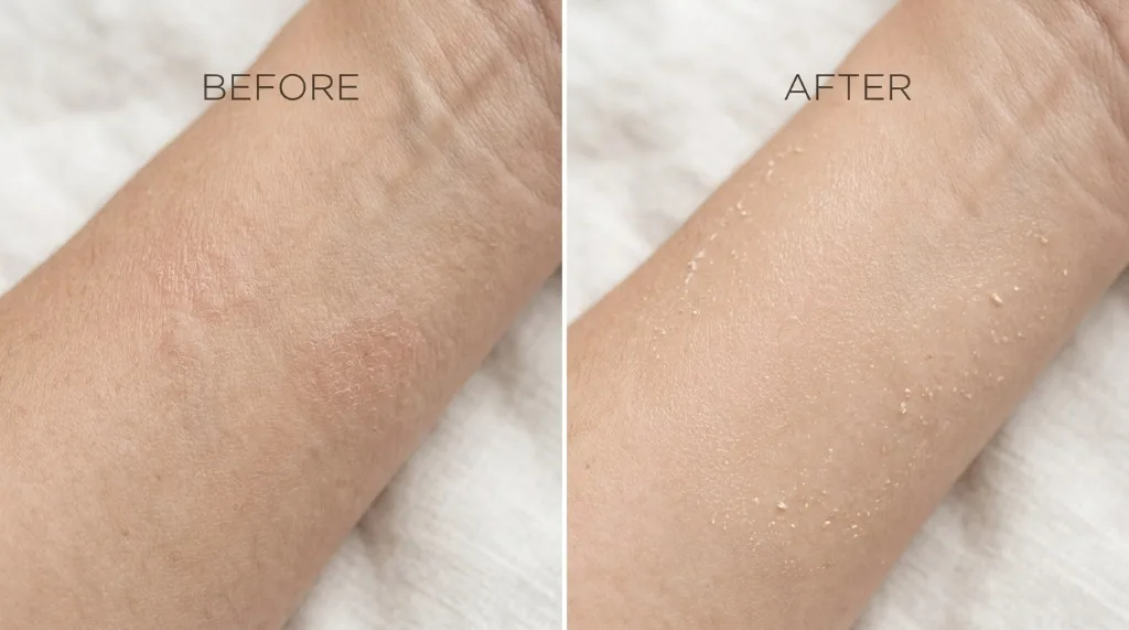 Supporting illustration 2 for Oatmeal for Skin: Evidence, Limits, and Safety